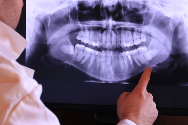 Best Broken Tooth Emergency  in Central, LA