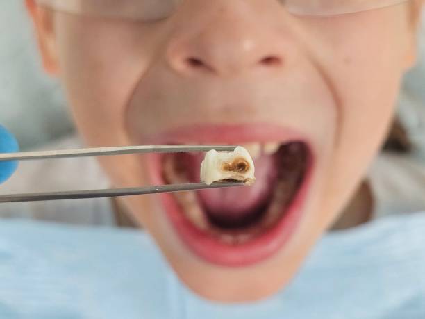 Best Tooth Pain Emergency Relief  in Central, LA