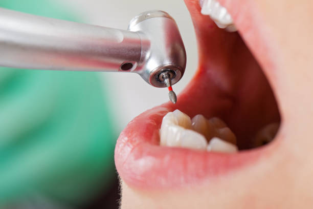 Best Dentist Open on Weekends  in Central, LA